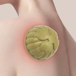 Wholesale four leaf clover silicone vacuum cupping